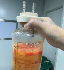 云梦水动力吸脂手术要做多久？